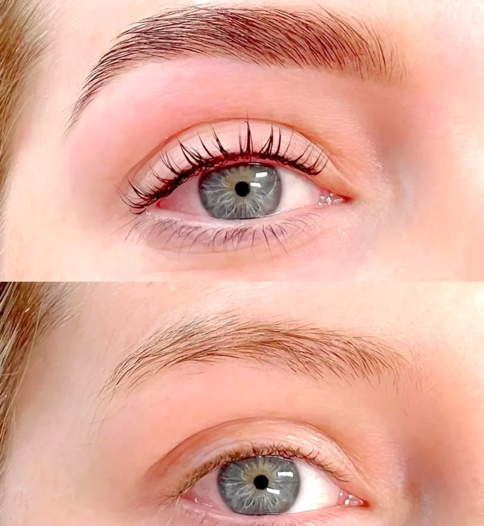 Backyard Bounty | Why Are Eyebrow Tattoos So Pricey? Healing Takes Time