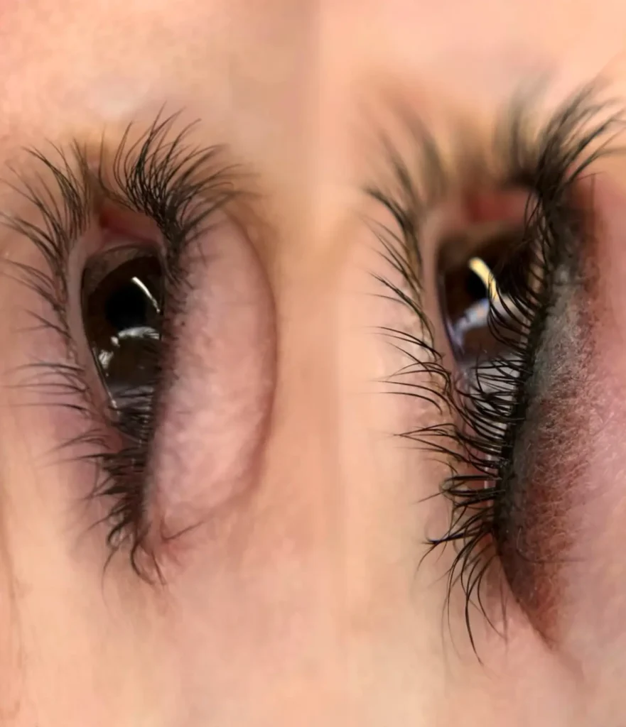 Melbourne’s Weather and Eye Tattoo Healing